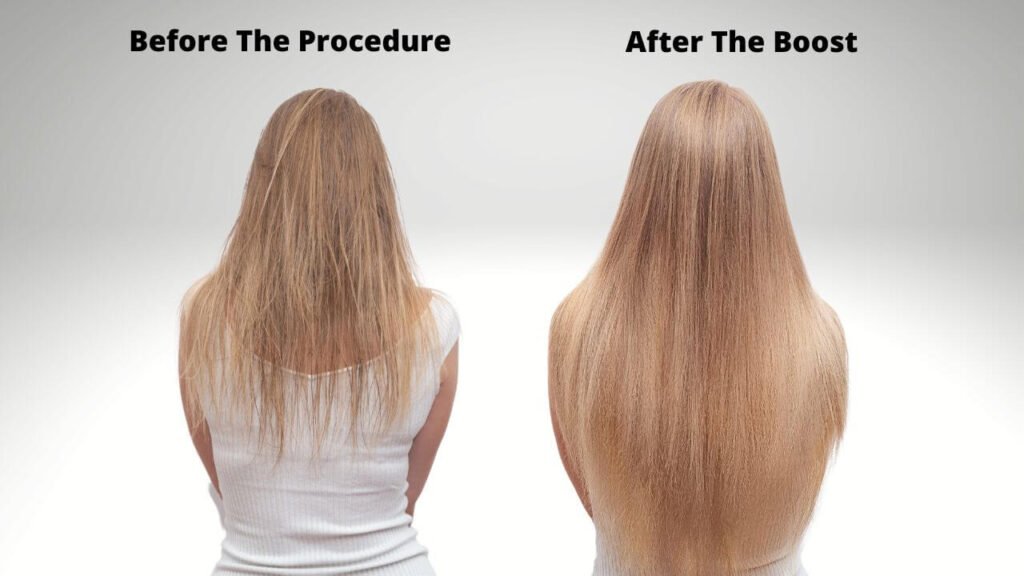 Six Months Of Hair Volume What Is Boost Up And Who Can Benefit From 